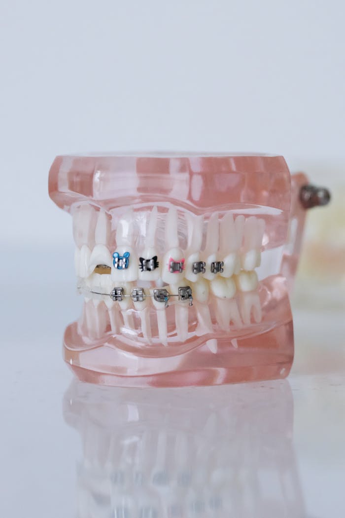 Close-up of a dental model showcasing braces in a clinical setting.